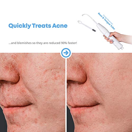 NuDerma Portable Handheld High Frequency Skin Therapy Wand Machine w/Neon – Anti-Aging - Skin Tightening - Wrinkle Reducing - Dark Circles – Blemish Control - Hair & Scalp Stimulator